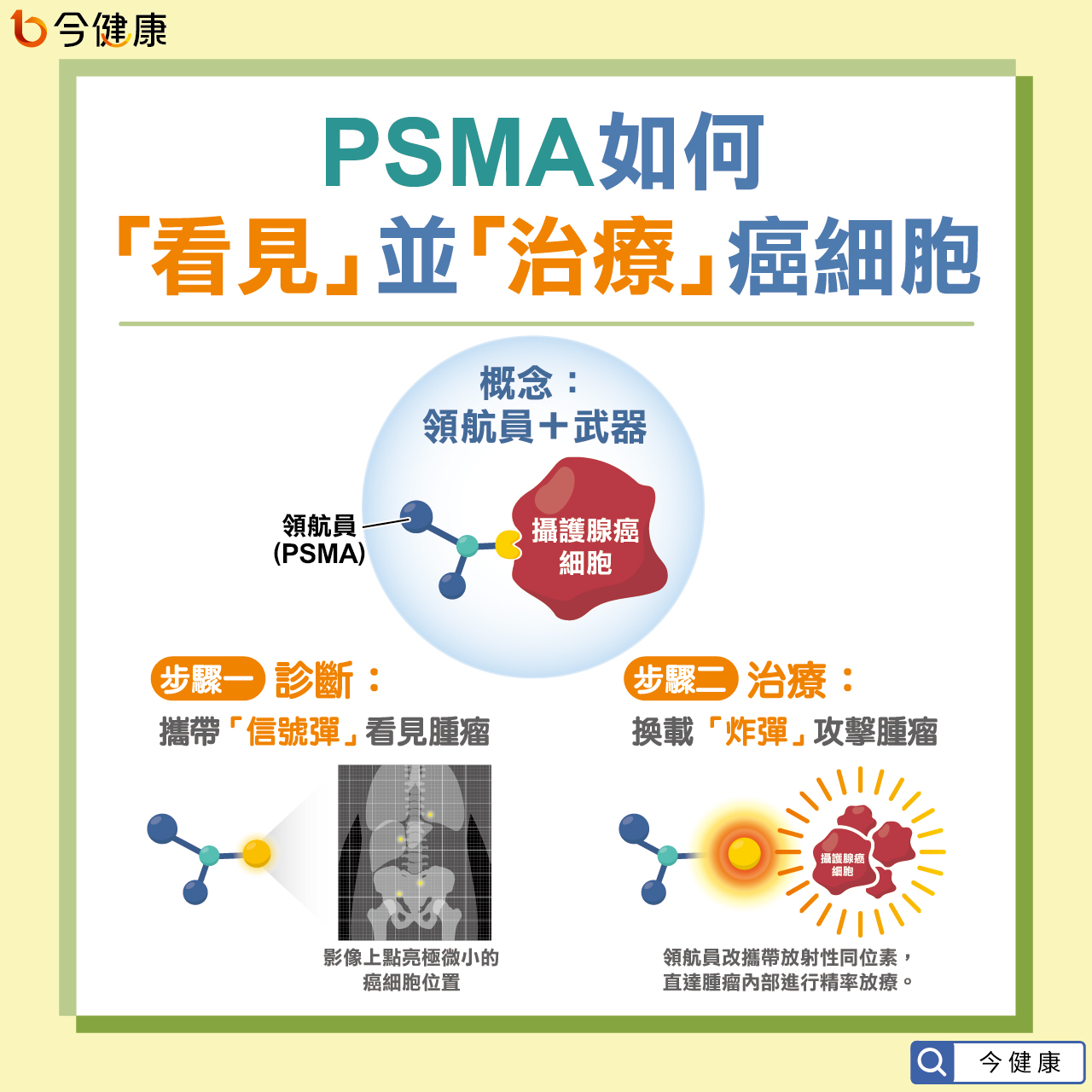 #台大 #臺大 #路景竹 #攝護腺癌 #放射性標靶治療 #PSMA 