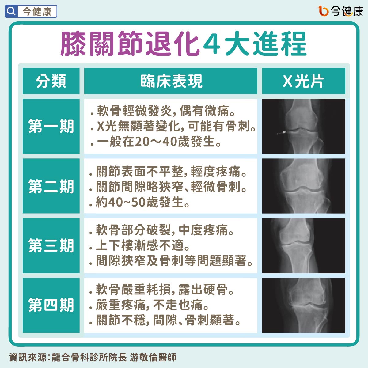 #膝蓋 #無力 #喀喀響 #老化 #關節 #退化性關節炎 #退化性膝關節炎