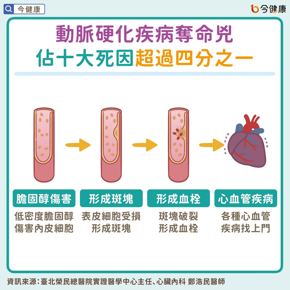 動脈硬化疾病奪命兇　佔十大死因超過四分之一